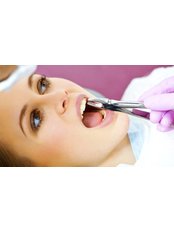 Non-Surgical Extractions - Ribagin Dent