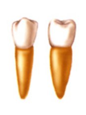 Premolar Root Canal - Ribagin Dent