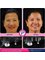Pka Chhouk Dental Clinic - implant and crown  