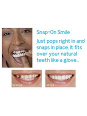 Snap-On Smile™ - SunnyView Dental Georgetown