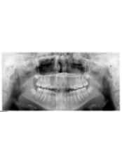Digital Panoramic Dental X-Ray - The Braces Doctor-Dr. Timothy R. Agapas