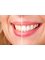 Denture clinic - Teeth Whitening 