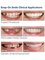 Integrative Health Group - Snap-On Smile 