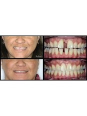 Dentist Consultation - DentisteALaval.com