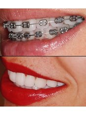 Orthodontics - Dental Experience