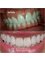 Sonrisa Perfecta Dental-Tarsys Loayza Roys - bocagrande avenida 3 # 6-128 edificio centro de negocios 2do piso, Cartagena,  29