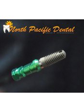 Dental Implants - North Pacific Dental