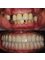 Galeria Dental - Oral Hospital - all-on-x 