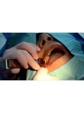 Non-Surgical Extractions - Clínica Dental O.C.I Liberia