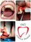 Clínica Dental O.C.I Liberia - Implant surgery 