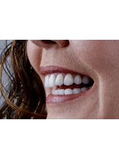 Porcelain Veneers - Aesthetic Dental Care