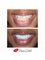 Prisma Dental - Smile makeover 