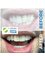 Costa Rica Dental Team - Porcelain crowns on Anterior teeth 