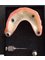 Dental Implants Trejos Costa Rica - 100mts este de la escuela Roossvelt Sanpedro y 50 sur, San Pedro, San Jose, 506 84654395,  10