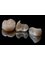Dental Solutions Tamarindo - Zirconia crowns, More Natural an resistant 
