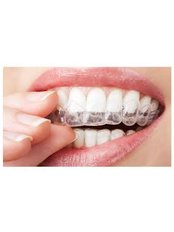 Orthodontic Retainer - Dental Solutions Tamarindo
