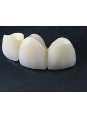 Porcelain Crown - Dental Clinic Dunđerović Knez