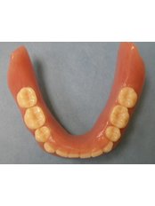 Acrylic Dentures - Dental Clinic Dunđerović Knez