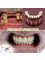 DentalPro - All on 4 with metal ceramic 
