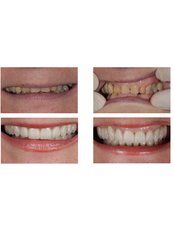 Dentist Consultation - iDentic