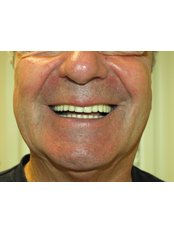 Dental Implants - Smile Studio