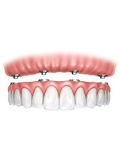 All-on-4 Dental Implants - Dental Care Croatia