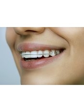 Orthodontic Retainer - Dental Care Croatia