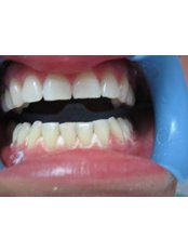 Cosmetic Dentist Consultation - Dental Clinic Dr. Damir Dekorti