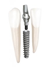 Dental Implants premium NOBEL BIO CARE - B Dent