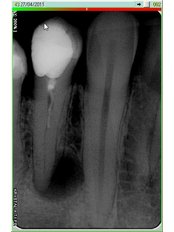 Digital Dental Radiology - Mr. Sci. Ivo Matkovic Dr. Med. Dent.