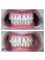 VISODENT Dental and Face Clinic - Visodent - aesthetic crowns 
