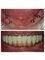 VISODENT Dental and Face Clinic - Visodent - All-on-4 