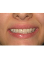 Cosmetic Dentist Consultation - Dr. Kalia Tsangari