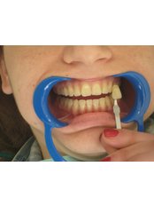 Teeth Whitening - Dr. Kalia Tsangari