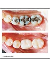 Dentist Consultation - Dr. Antoniou Antonis - Dental Center
