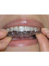 Invisalign™ - Smalto Dental Clinic