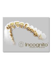 Incognito™ Braces - Argyrou Orthodontics
