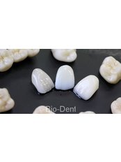 Ceramic veneer CEREC e.max CAD (anterior teeth) - BioDent tour s.r.o.