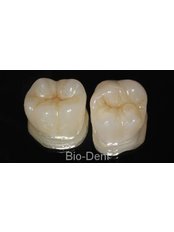 Full ceramic crown Cerec e.max CAD (posterior teeth) - BioDent tour s.r.o.