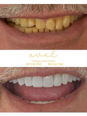 DSD - Digital Smile Design - Eval Clinique