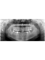 Digital Panoramic Dental X-Ray - Confidental Studio