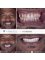 Dr. Jepssy Beltre DDS - Dental Implants and Porcelain Veneers 