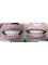 Hispadent - Jose Alonso MD, DDS, FACS - Smile Makeover 