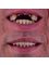 Hispadent - Jose Alonso MD, DDS, FACS - Dental Implants 
