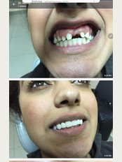 Dentental Implant Consultant - El-shatby, Alexandria, Egypt, 