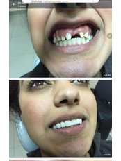 Dentental Implant Consultant - El-shatby, Alexandria, Egypt,  0