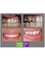 Cairo Smile Dental Care - Comprehensive cosmetic dentistry: crowns, tooth colored fillings, teeth whitening and gum surgery. 
