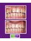 Cairo Smile Dental Care - Cosmetic dentistry- tooth colored fillings.  