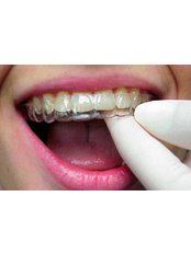 Orthodontist Consultation - Dental Care Egypt
