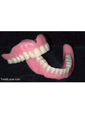Acrylic Dentures - Dental Experts Clinic